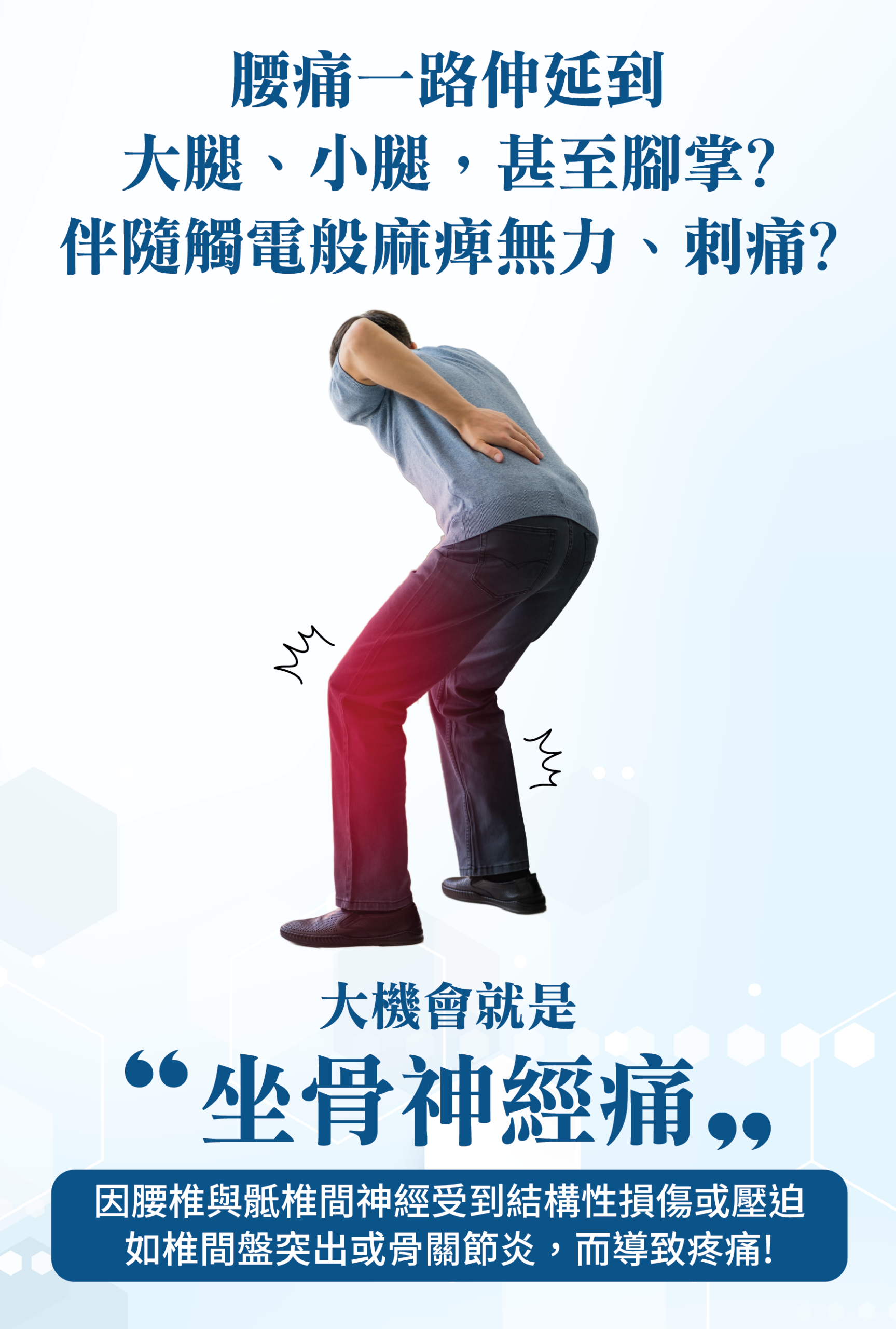 腰痛一路伸延到 大腿、小腿，甚至腳掌？ 伴隨臀電般麻彈痛力，刺痛？ 大機會就是 「坐骨神經痛」 因腰椎與硬脊膜神經受到結構性損傷或壓迫 如椎間盤突出或骨關節炎，而導致發痛！